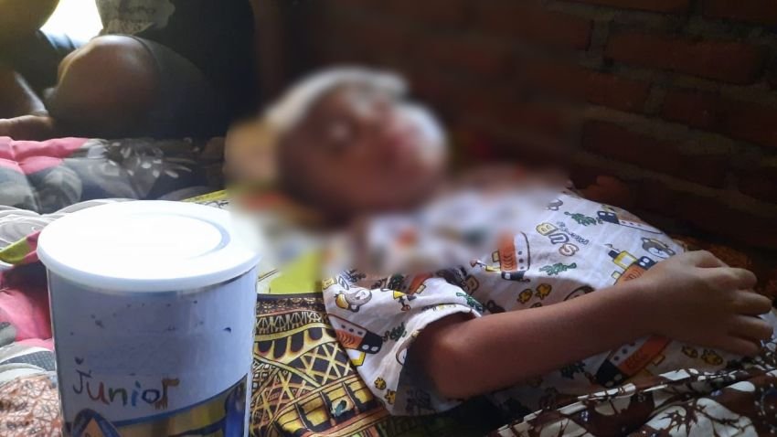 Anak Penderita Meningitis TB di Tapsel Butuh Bantuan Dermawan