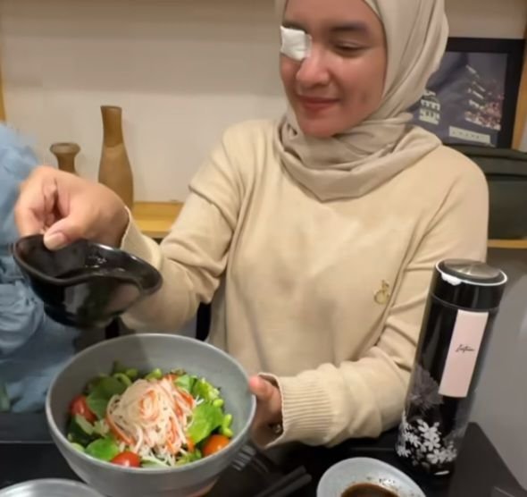 Gawat! Retina Mata Intan Nuraini Terkelupas
