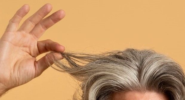 Awas! Ada Wabah Rambut Rontok; Satu Pekan Langsung Botak