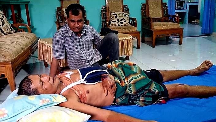 Kakek Pengantar Koran di Medan Dibegal hingga Patah Tulang Bahu