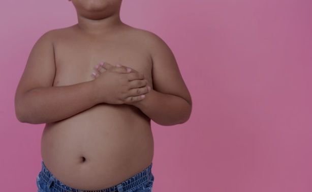 Obesitas Bisa Bikin Anak Alami Mikropenis