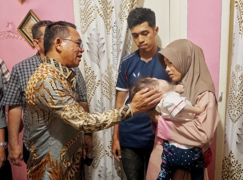 Sentuhan Kemanusiaan Zakiyuddin, Balita Mikhayla Penderita Kanker Mata Langsung Dirujuk ke RS