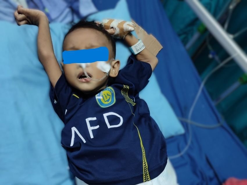 Kisah Pilu Abgari, Balita 3 Tahun di Sidimpuan Idap Tumor Perut