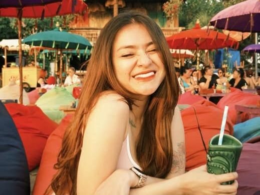 Mau Kurusi Badan, Nathalie Holscher Pilih Operasi Bariatrik