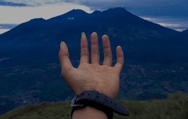 Sering Sentuh Pusar dengan Tangan Bisa Picu Penyakit