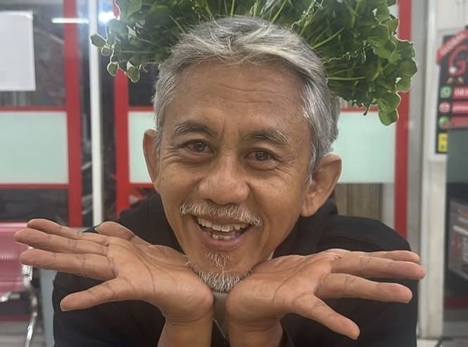Epy Kusnandar Meninggal setelah 15 Tahun Divonis Tumor Otak